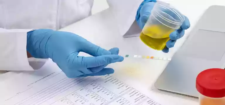 Utility of Urine ACR test